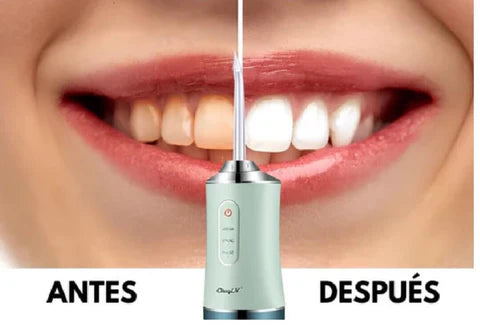 🌊👄 WAVESPRAY: IRRIGADOR ORAL 👄🌊