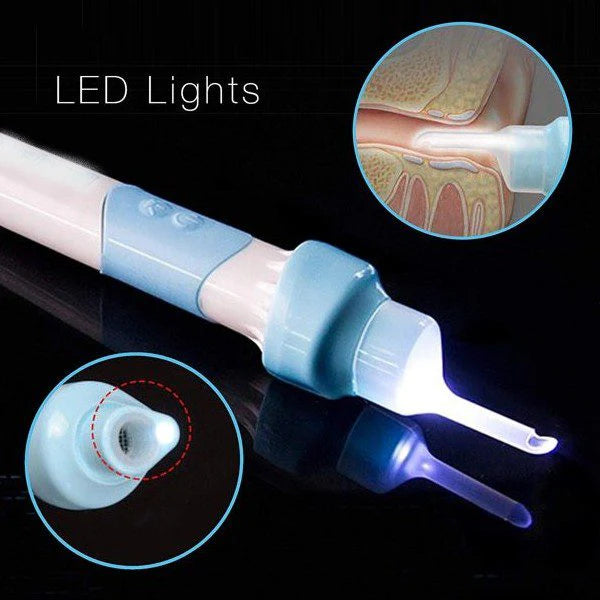 EARCLEAN: ASPIRADOR LIMPIEZA DE OIDOS👂✨