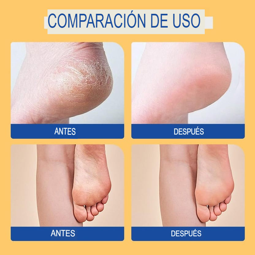 FOOT CARE: SET X2 CREMAS HIDRATANTES ULTRA PARA PIES✨🦶