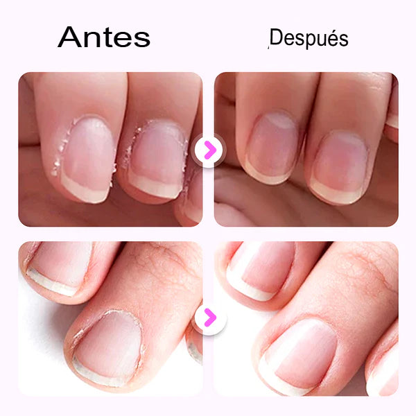 ESSENTIAL NAIL – PAGA 1 LLEVA 2 CUIDADO DE UÑAS CON ACEITES ESENCIALES 💅🌸
