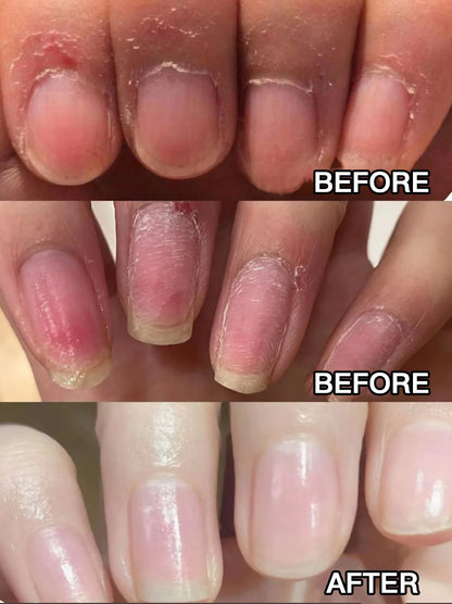 ESSENTIAL NAIL – PAGA 1 LLEVA 2 CUIDADO DE UÑAS CON ACEITES ESENCIALES 💅🌸