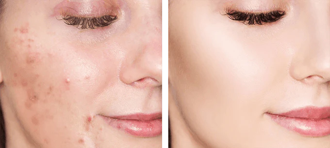 EASY GLOW: BASE FÁCIL APLICACIÓN✨💄