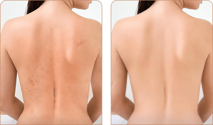 SKINCLEAN: 1+1 GRATIS TOALLA DE BAÑO EXFOLIANTE💦
