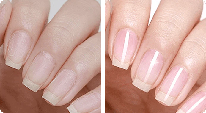 PAGA 1 LLEVA 2 NAIL REPAIR: REMOVEDOR DE HONGOS + FORTALECEDOR DE UÑAS (RESULTADOS EN 3 DÍAS) 💥💅