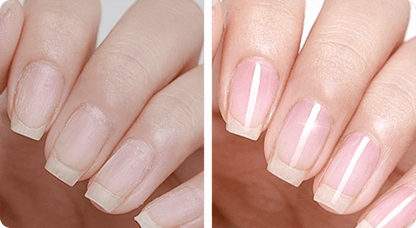 PAGA 1 LLEVA 2 NAIL REPAIR: REMOVEDOR DE HONGOS + FORTALECEDOR DE UÑAS (RESULTADOS EN 3 DÍAS) 💥💅