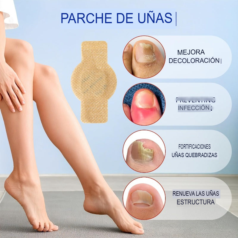 SET X 21 PARCHES TRATAMIENTO HONGOS 🦶🚫🍄