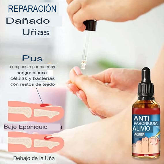 STOPHONGOS: SET X 3 LIQUIDO ELIMINADOR DE HONGOS 🚫🦠