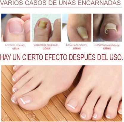 STOPHONGOS: SET X 3 LIQUIDO ELIMINADOR DE HONGOS 🚫🦠