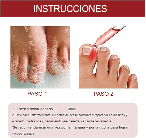 STOPHONGOS: SET X 3 LIQUIDO ELIMINADOR DE HONGOS 🚫🦠