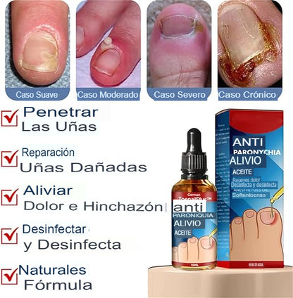STOPHONGOS: SET X 3 LIQUIDO ELIMINADOR DE HONGOS 🚫🦠