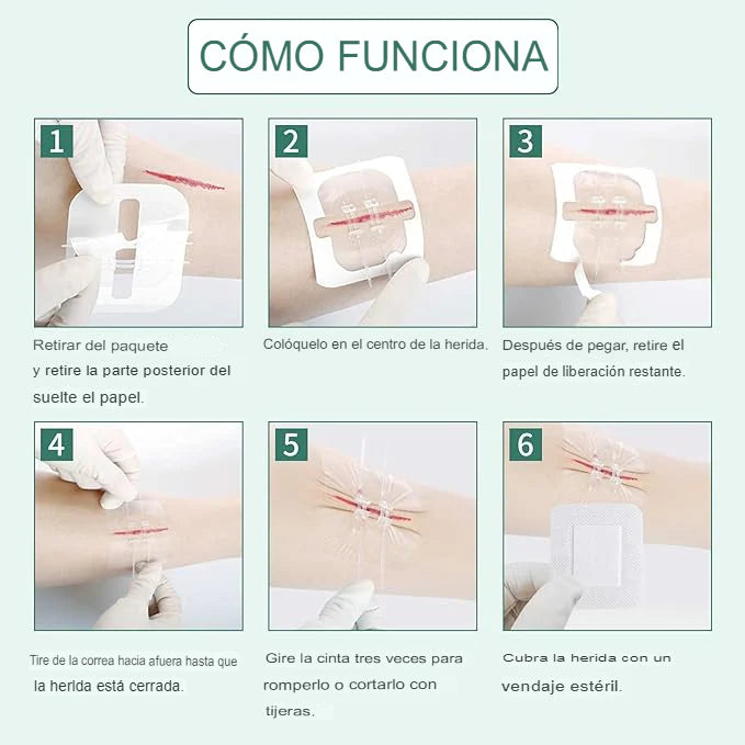 SET X4 ADHESIVO PARA CIERRE DE HERIDAS 🩹
