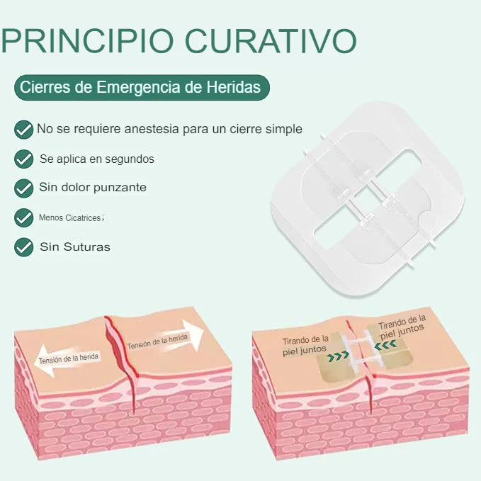 SET X4 ADHESIVO PARA CIERRE DE HERIDAS 🩹