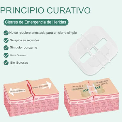 SET X4 ADHESIVO PARA CIERRE DE HERIDAS 🩹