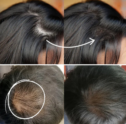 HAIRSHIELD: CUBRIDOR DE RAICES Y CANAS 💆‍♀️🌟