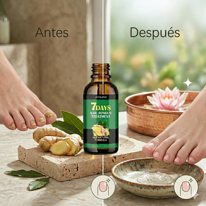 PAGA 1 LLEVA 2 NAIL REPAIR: REMOVEDOR DE HONGOS + FORTALECEDOR DE UÑAS (RESULTADOS EN 3 DÍAS) 💥💅