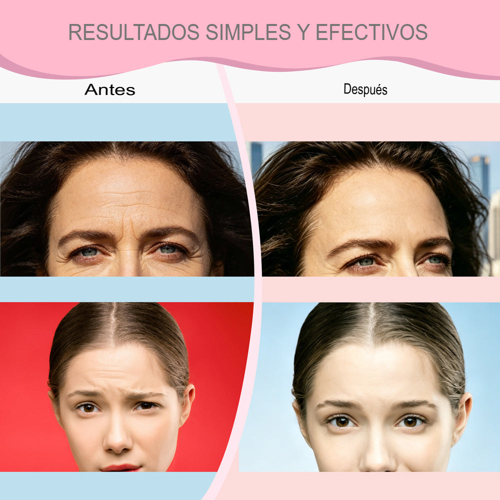 SKIN SMOOTH: PROMO 2X1 PARCHES ANTIARRUGAS💎🌸
