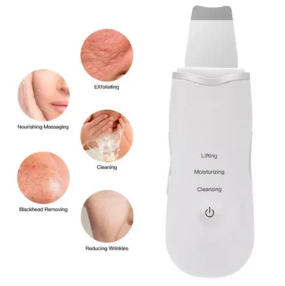 ULTRACLEAN: LIMPIADOR FACIAL ULTRASÓNICO ✨🌟