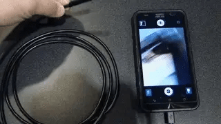 VISION PRO: ENDOSCOPIO DIGITAL🔍