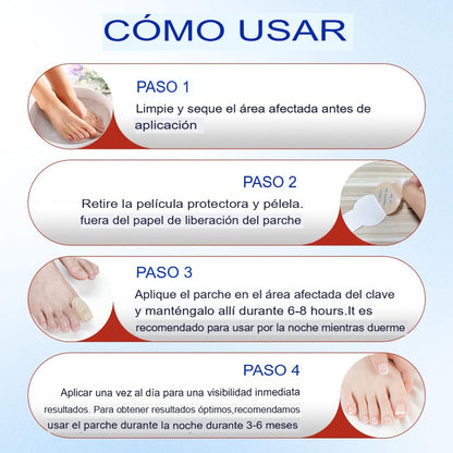 SET X 21 PARCHES TRATAMIENTO HONGOS 🦶🚫🍄