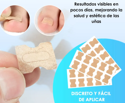 TOEPATCH: PARCHES PARA UÑAS ENTERRADAS 🦶🌟
