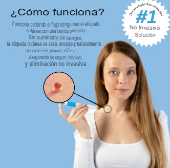 SKINCLEAN: KIT REMOVEDOR BERRUGAS