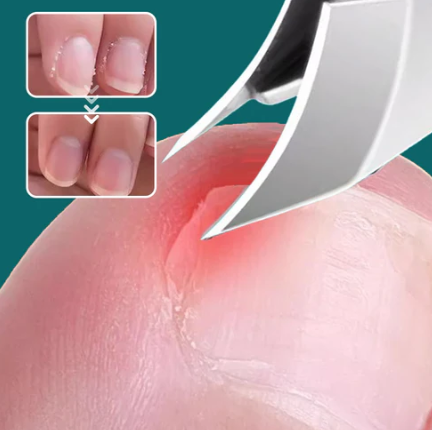 NAILFIX: CORTA UÑA ESQUINAS 💅