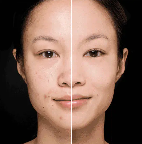 PEEL&GLOW: MASCARILLA EXFOLIANTE 💫🧽