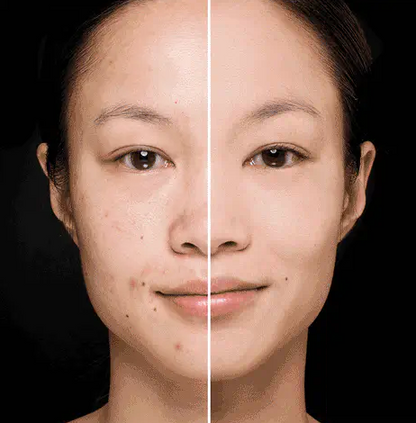 PEEL&GLOW: MASCARILLA EXFOLIANTE 💫🧽