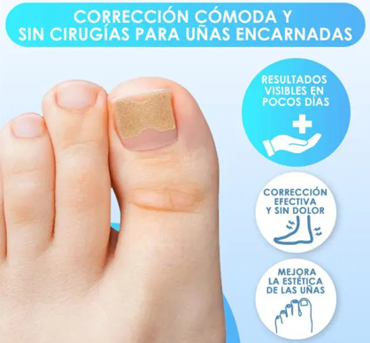 TOEPATCH: PARCHES PARA UÑAS ENTERRADAS 🦶🌟
