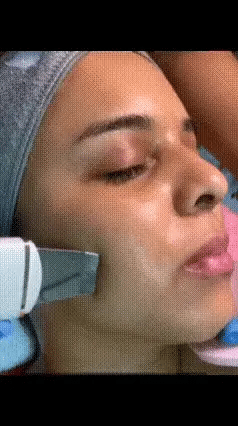 ULTRACLEAN: LIMPIADOR FACIAL ULTRASÓNICO ✨🌟