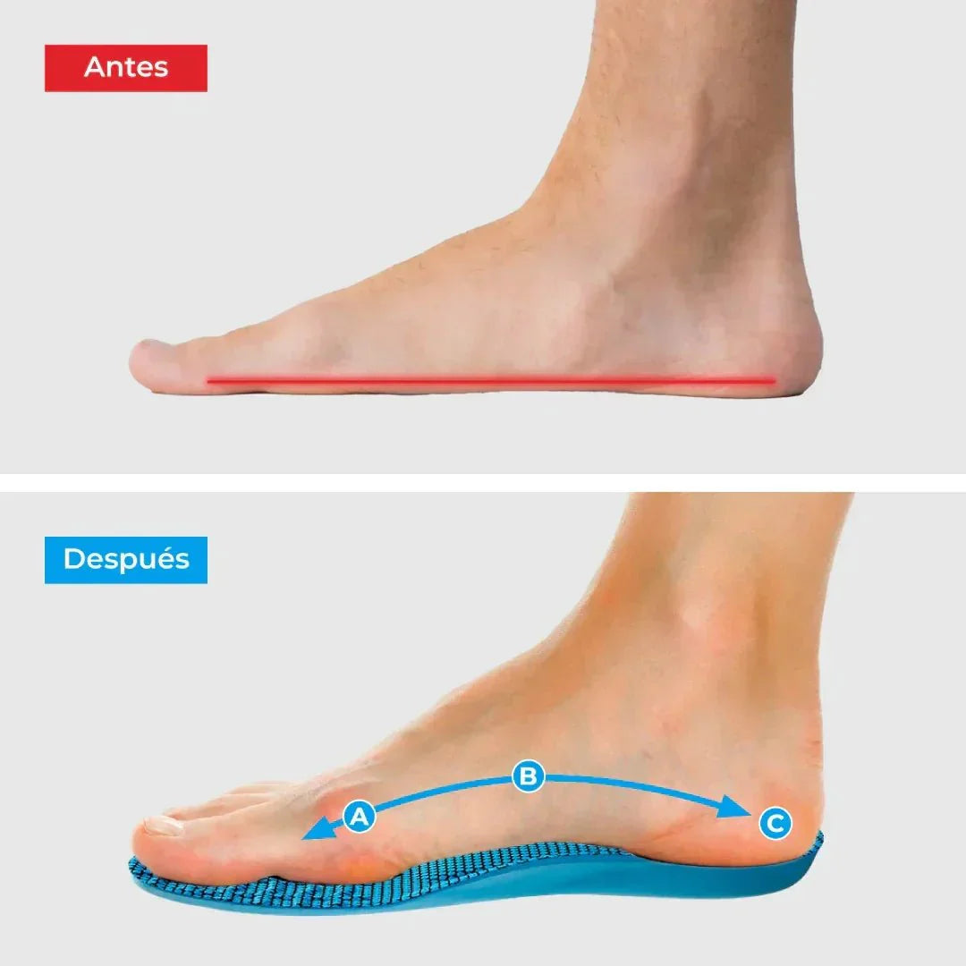 FOOT PLUS: PLANTILLAS PARA JUANETES💎👣