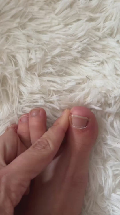 TOEPATCH: PARCHES PARA UÑAS ENTERRADAS 🦶🌟