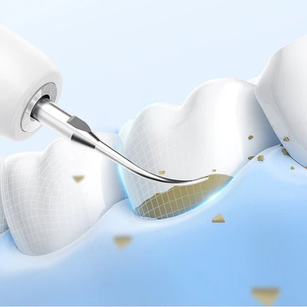 DENTALCLEAN: LIMPIADOR DENTAL ULTRASÓNICO🦷⚡