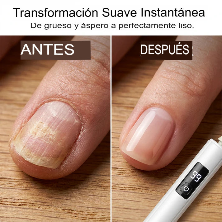 POLICHADOR DE UÑAS💅✨
