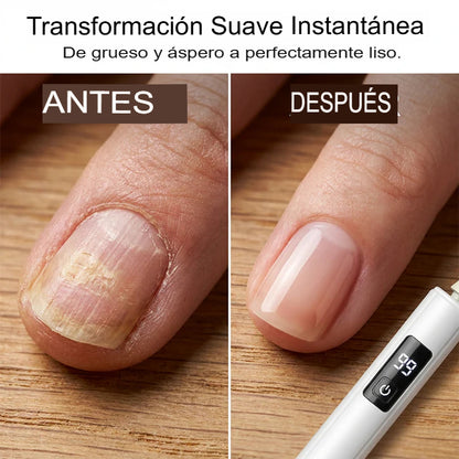 POLICHADOR DE UÑAS💅✨